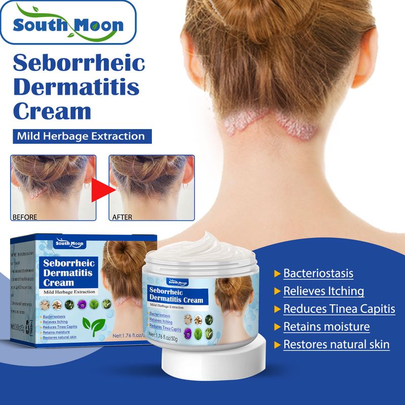 Cremă seboreică South Moon pentru repararea problemelor pielii precum acneea, mâncărimea și psoriazisul de pe cap_voghion.com