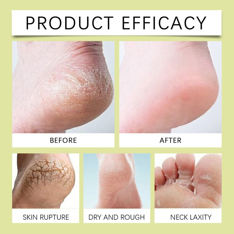 Exfoliantul pentru picioare curăță delicat keratina și pielea moartă a picioarelor, hidratează și netezește pielea._voghion.com