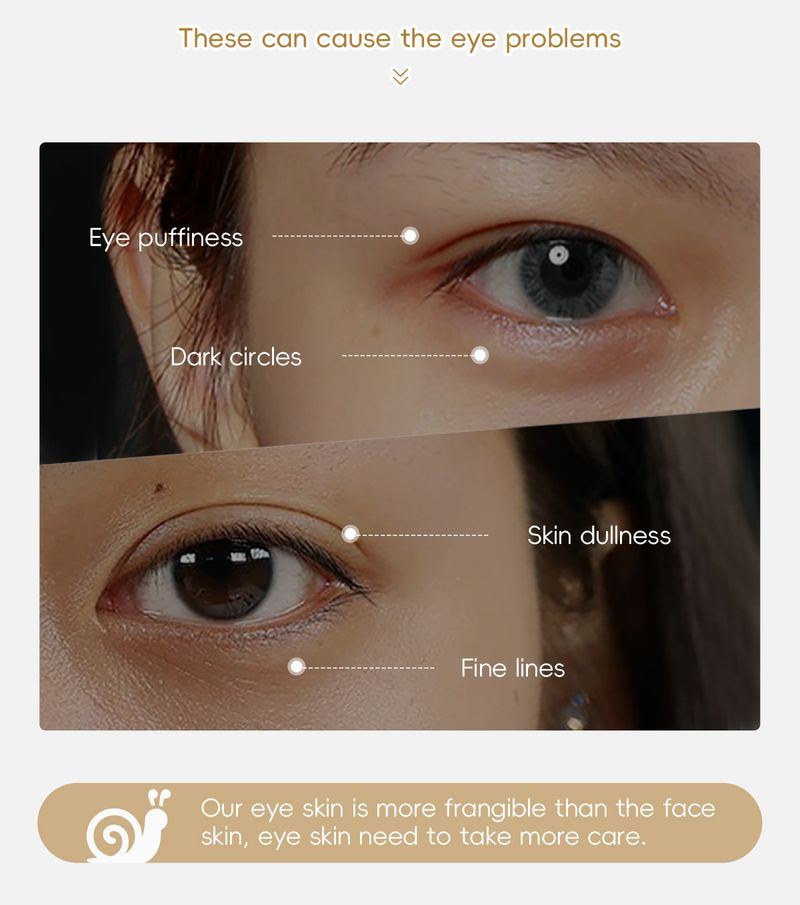 LAIKOU Red Ginseng Snail Eye Cream 15g Hydrating And Moisturizing To Protect Eye Skin_voghion.com