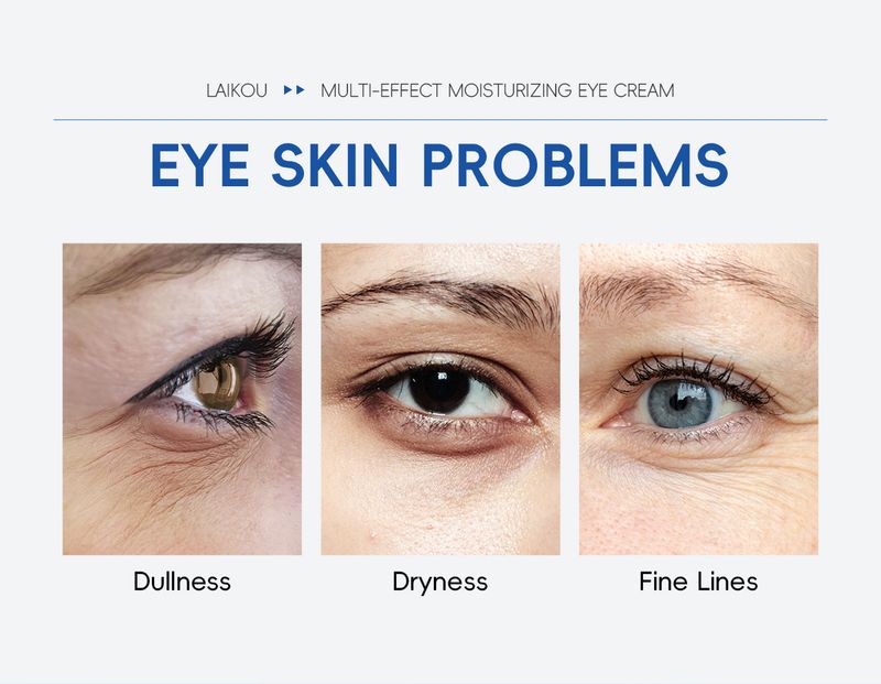 Κρέμες Ενυδατική Κρέμα Ματιών με Ρόλερ 20g Ενυδατική Φροντίδα Ματιών Προϊόντα Περιποίησης Δέρματος Ματιών_voghion.com