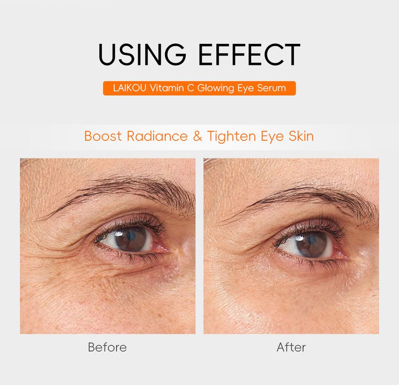 LAIKOU Suero para ojos con vitamina C 30 ml Cuidado cosmético para ojos_voghion.com