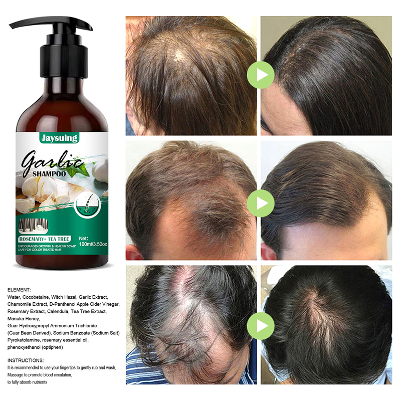 Jaysuing Garlic Relieving Itching, Removing Dandruff, Shampoo for Growth, Preventing Hair_voghion.com