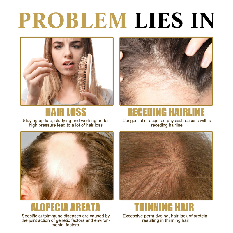 OUHOE ženšenni massaaž Niisutav peanahk, tugevad juuksed, pinguldav, väljalangemisvastane hooldus, tihe juukseessents_voghion.com