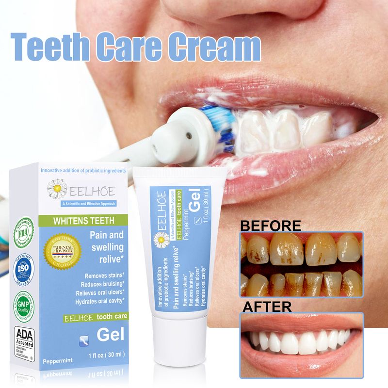 EELHOE Gel probiotico Pulizia delle macchie Prevenzione della carie dentale Alito fresco Sbiancamento dei denti_voghion.com