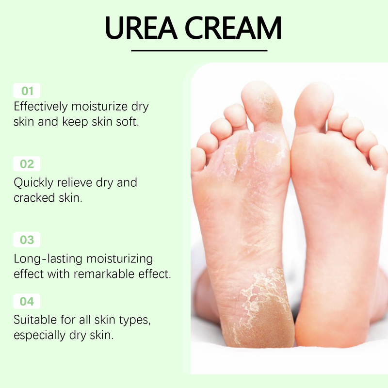 Wiyun Hand And Foot Urea Cream Hydrates And Moisturizes Foot Skin To Prevent Cracking And Drying Foot Cream_voghion.com