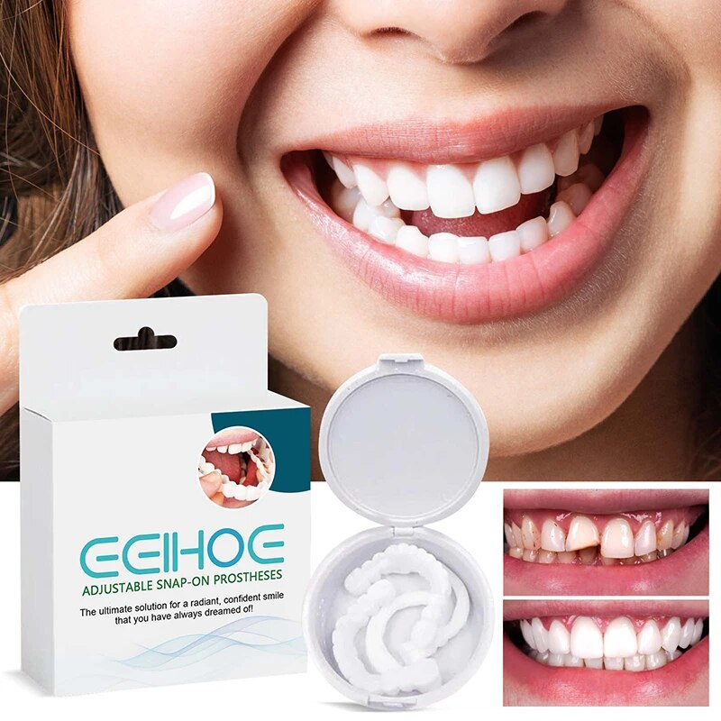 Set regolabile Impiallacciatura sorridente istantanea Sbiancamento denti per protesi Decora gli spazi tra i denti_voghion.com