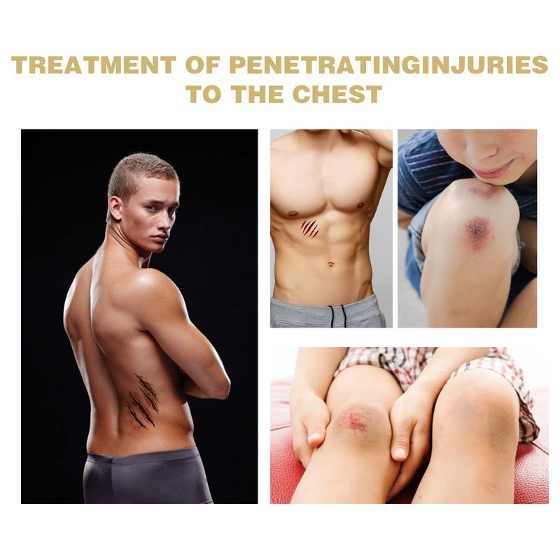 South Moon Trauma Wound Protect Skin from Trauma, Stop Bleeding, Breathable, Waterproof, and Elastic Bandage Patch_voghion.com