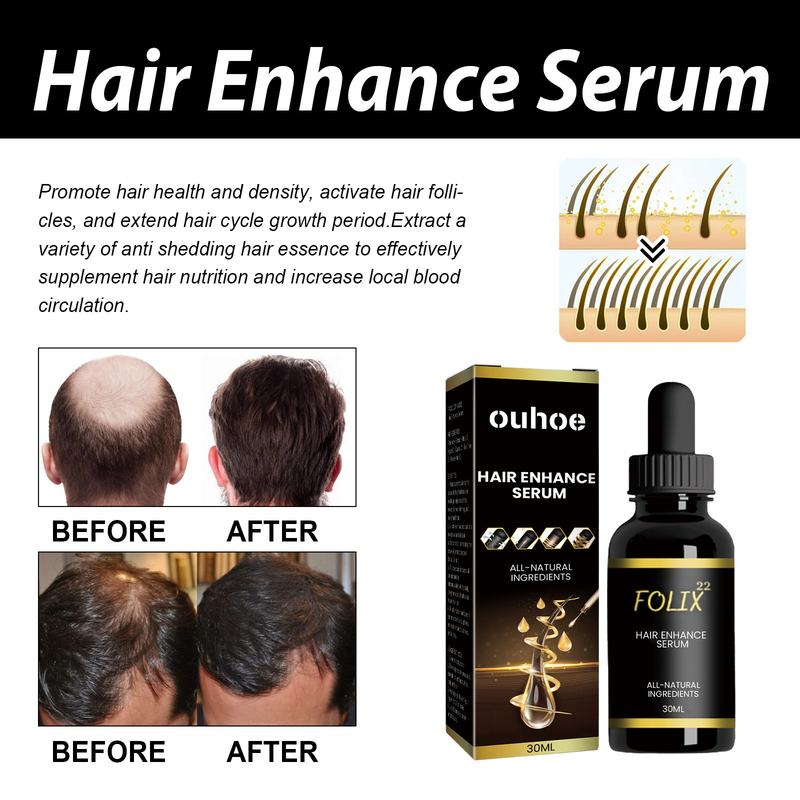 OUHOE Dense idrata le radici, ripara i capelli, ripara l'olio essenziale per la cura dei capelli danneggiati, secchi e furiosi_voghion.com