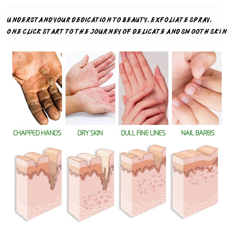 Spray Esfoliante Corpo, Mãos e Pés, Alivia a Pele Morta, Esfolia Hidrata e Limpa Profundamente_voghion.com