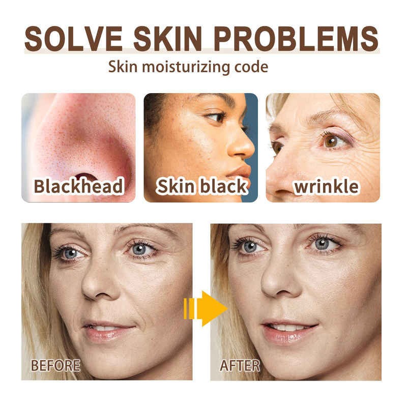 EELHOE – masque facial nettoyant en profondeur à base de plantes, raffermissant les pores et hydratant pour la peau, les points noirs du nez_voghion.com