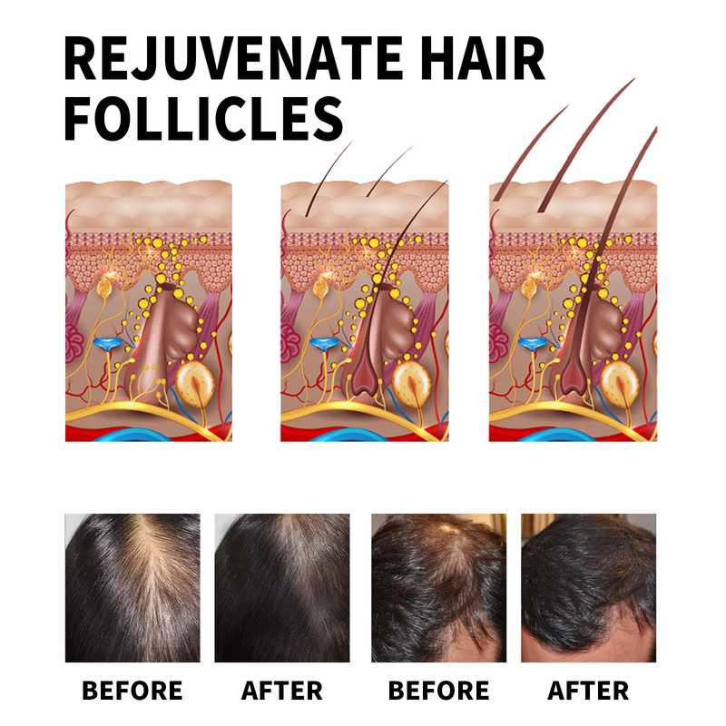Jayswing essence massaggio cuoio capelluto tonico olio capelli forti_voghion.com