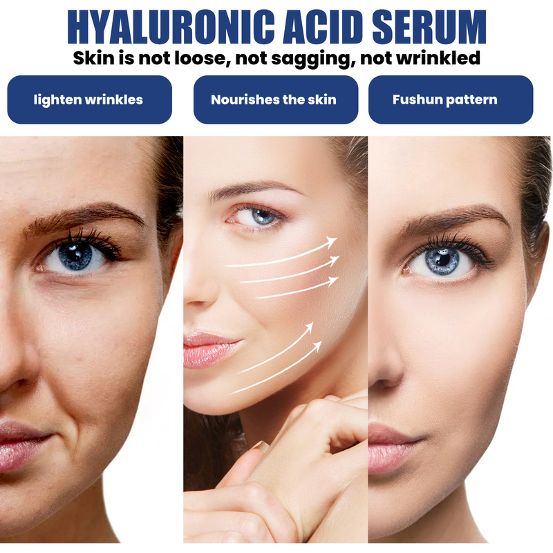 Anti Aging Serum Hyaluronic Acid Original Liquid Fade Wrinkle Fine Lines Shrink Pores Firming Whitening Vitamin C Facial Essence_voghion.com