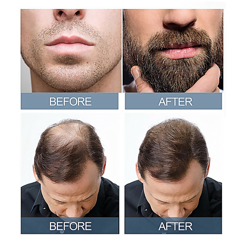 OUHOE Massaggio alle erbe Idratante Radice dei capelli del cuoio capelluto Resistente e morbida Essenza per la cura della barba densa_voghion.com