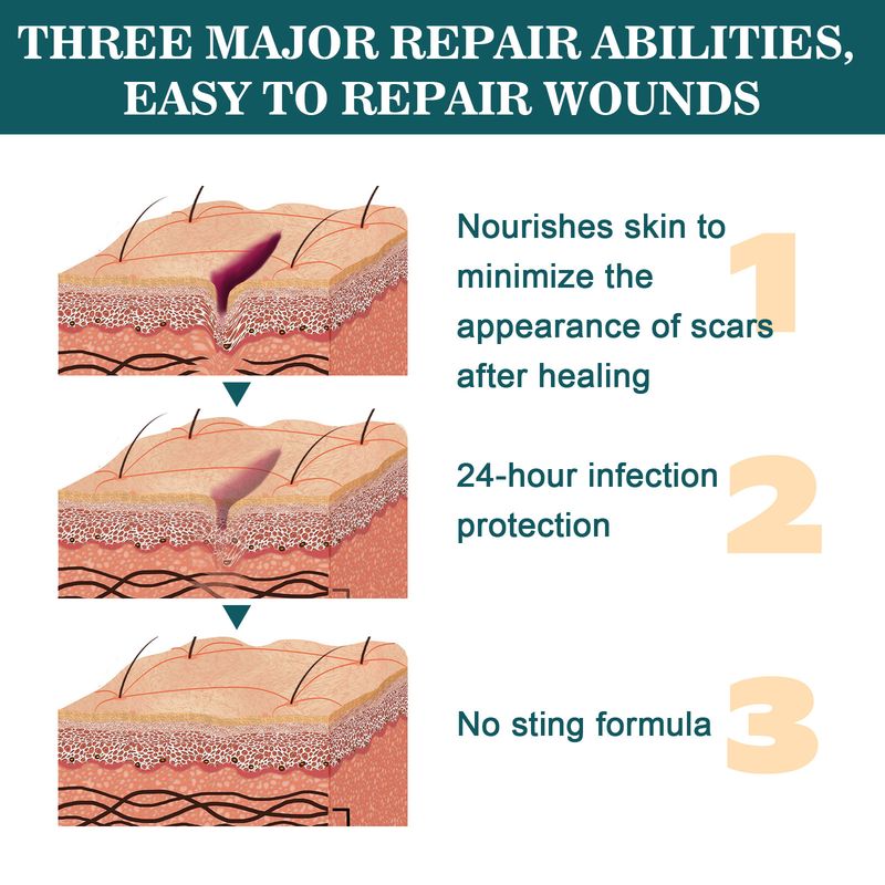 Ximonth Repair Relieving Scratches And Traumas, Fading Scars, Moisturizing Skin Care Cream_voghion.com