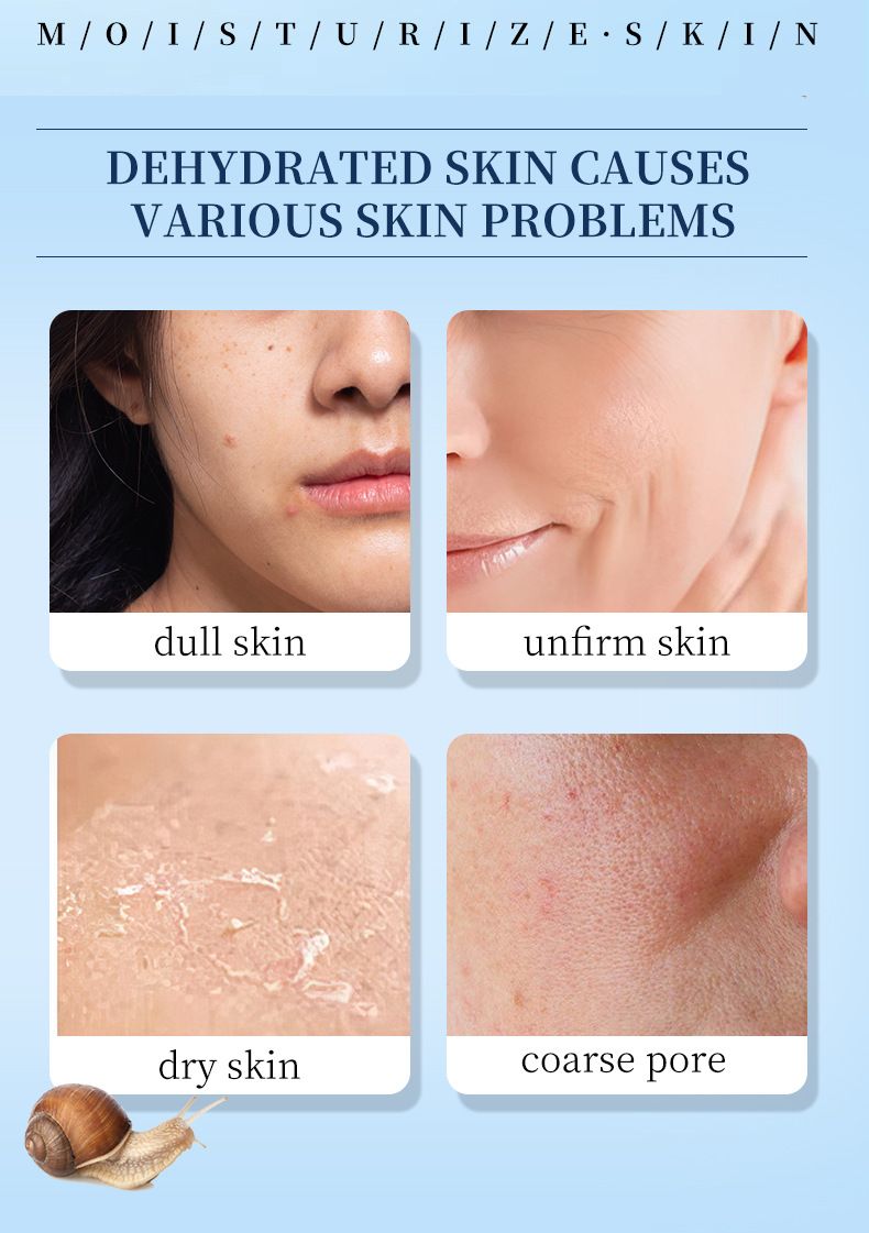 Snail Moisturizing Hydrating Face Cream - 50g Anti Aging Moisture Rich Facial Cream, Repairing Hydrator For Dry Skin, Natural Snail Mucin Skincare_voghion.com
