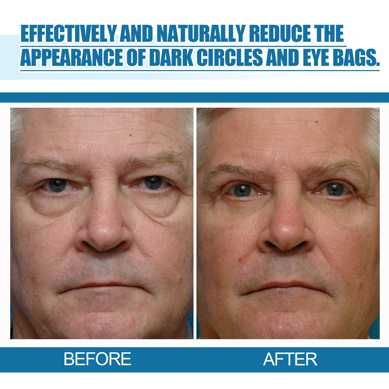 men's eye Beautiful essence reduces fine lines around the eyes, moisturizes and tightens the skin around the eyes s, s_voghion.com