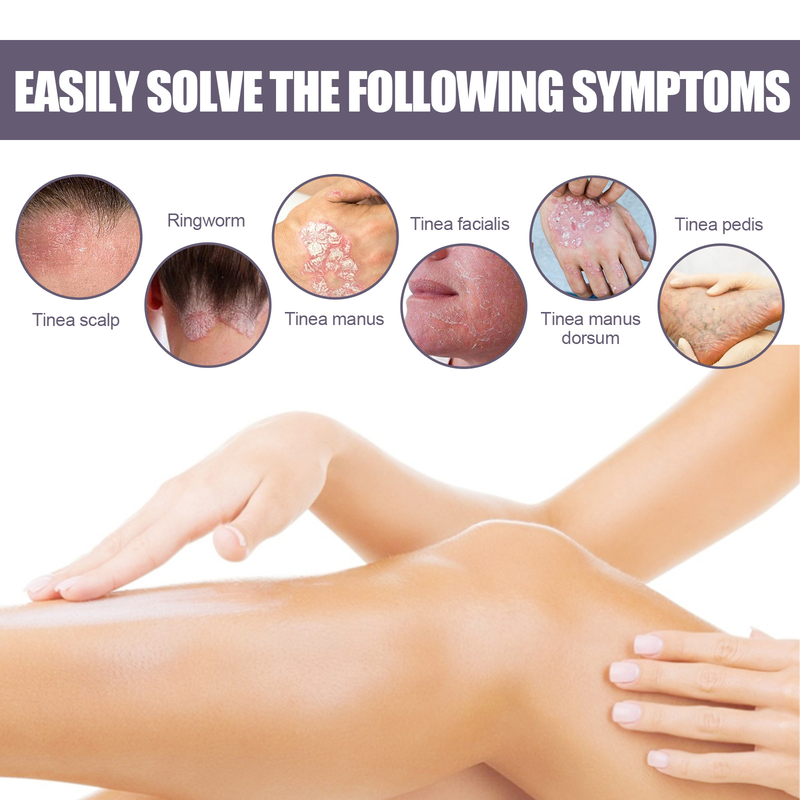 EELHOE hand and foot moss repair relieve itching skin care Knockout spray_voghion.com