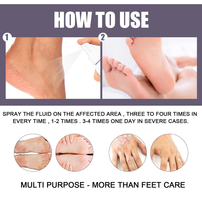 2025 Hand Foot Relieves Dry Rough Skin, Nourishes, And Moisturizes Skin Care Spray_voghion.com