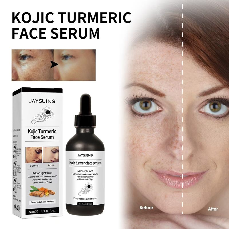 Curcumic acid can effectively fade and remove dark spots on the face essence oil_voghion.com