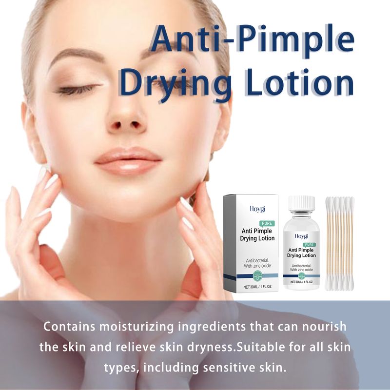 Hoygi Anti-Pimple Drying Lotion, Facial Cleansing And Repair Lighten Acne Marks And Pits, Close Your Mouth And Mild Skin Cream_voghion.com
