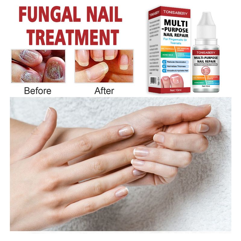 Cuidados com os pés 10ml, hidratante e reparador para unhas grisalhas, líquido iluminador e hidratante para unhas_voghion.com