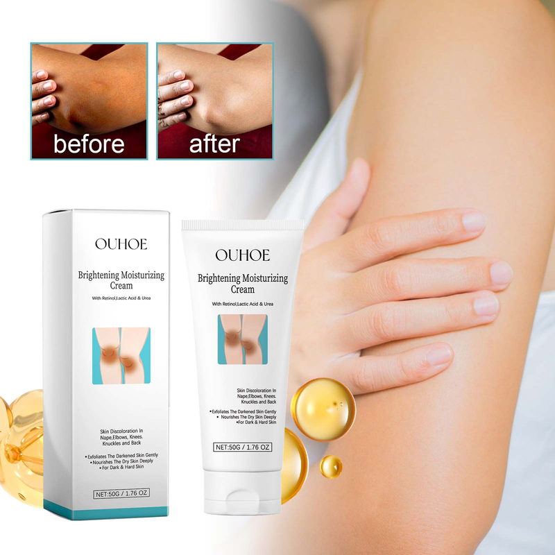 Cremă reparatoare OUHOE Black Thorny Skin pentru piele ternă, piele închisă la culoare la articulația genunchiului subrațului, hidratantă, curățătoare, reparatoare_voghion.com