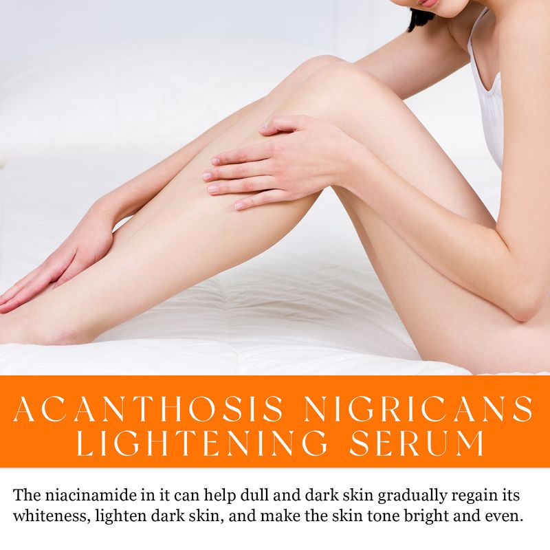 2024 new Acne Whitening Elbow, Axillary, Knee Joint, Black Skin Brightening essence_voghion.com