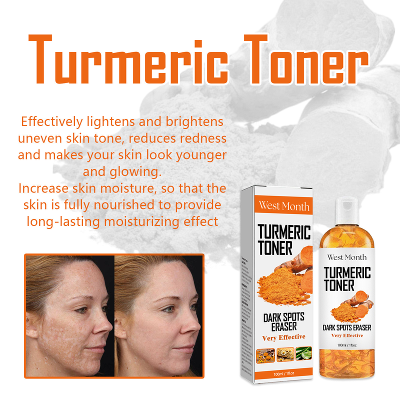 West&Month Black Turmeric Erfrischendes, tiefenwirksam hydratisierendes, straffendes, feuchtigkeitsspendendes und feuchtigkeitsspendendes Gesichtswasser_voghion.com