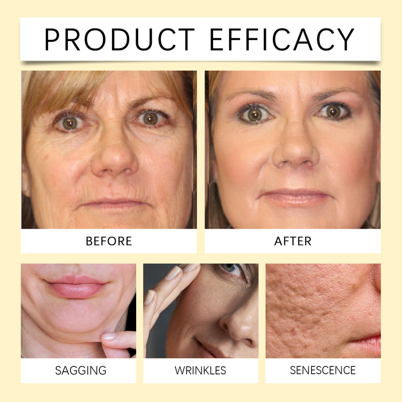 Hoygi Cleansing Peel Peel Mask Gently Cleanses Blackhead Pores And Moisturizes Skin Without Tightening_voghion.com