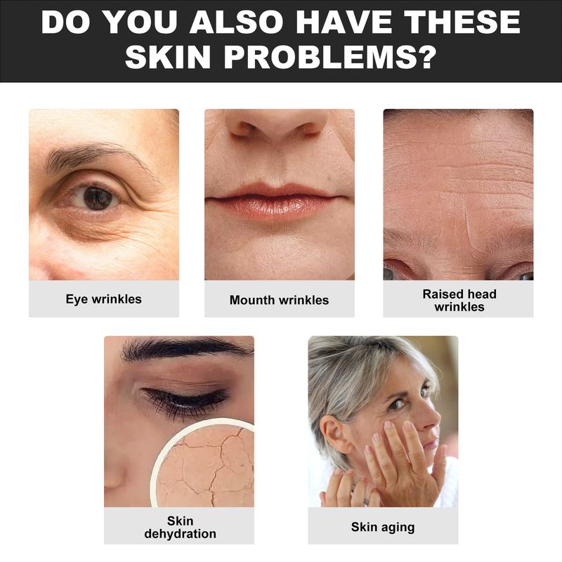 EELHOE wasserlösliches Kollagen-Wangenpflaster reduziert Falten, Anti-Falten, Anti-Aging, Lifting und feuchtigkeitsspendendes Gesicht_voghion.com