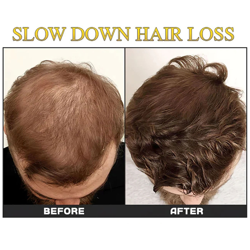Essenza densa di sfere per capelli EELHOE_voghion.com