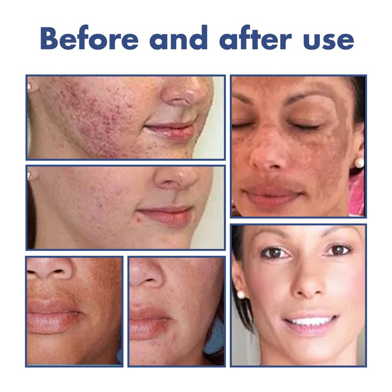 OUHOE Sort, tornet hudrens til dybderensning, blødgøring, reparation, oliekontrol og rensning af ansigtet_voghion.com