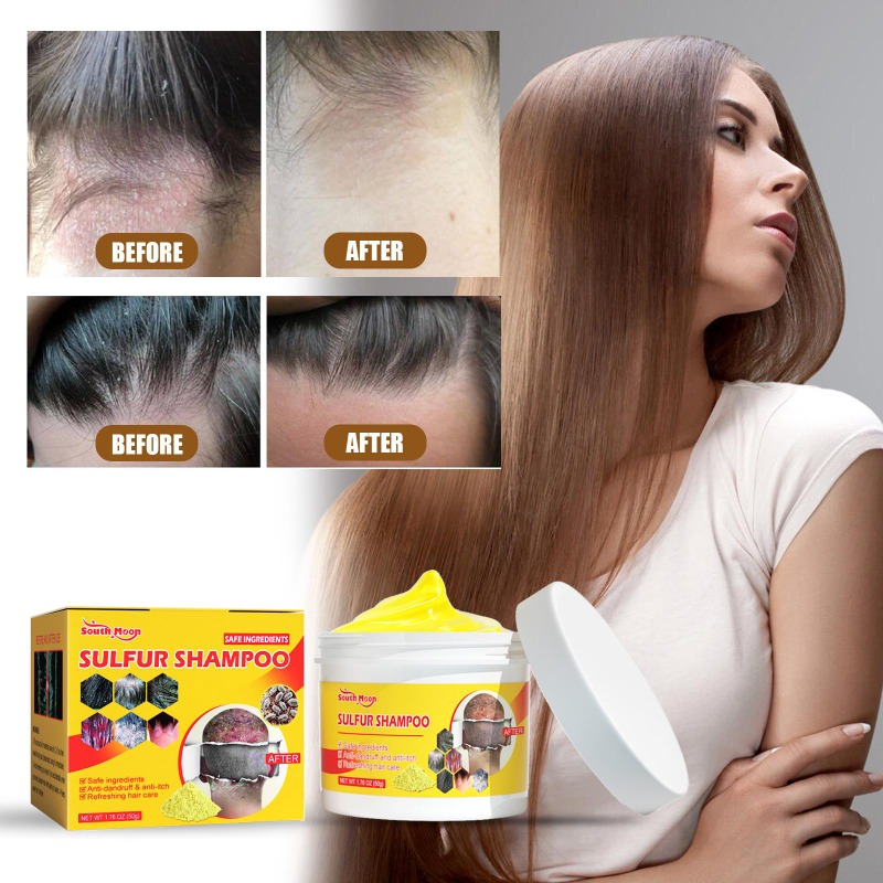 Sulfur Shampoo 50g Remove Lice Mites Dandruff Itching Oil Cleaning Scalp Deep Hair Antipruritic Follicles Cleaning_voghion.com