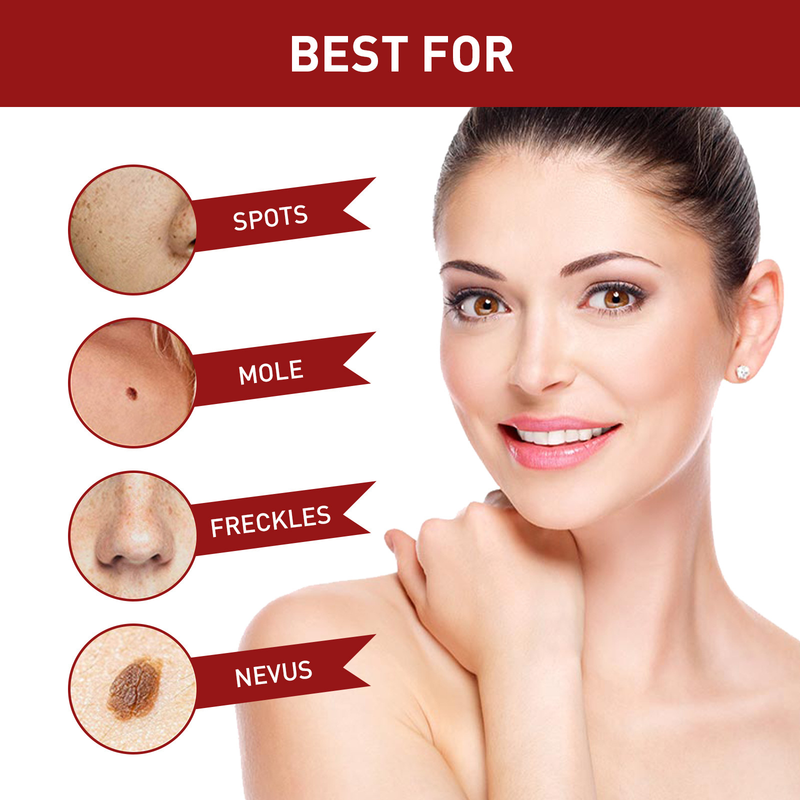 Anti Mole pour un nettoyage en profondeur de la peau, élimination des verrues, dessalinisation des grains de beauté noirs, réparation et lissage_voghion.com