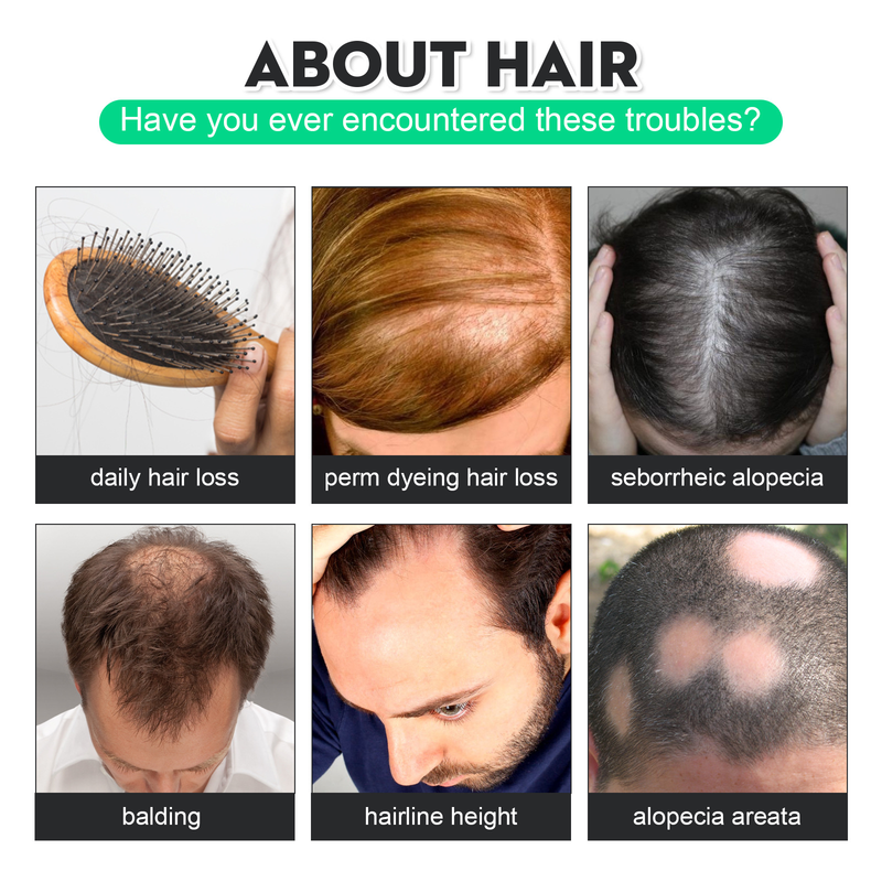 Essência de crescimento capilar masculino East Moon_voghion.com