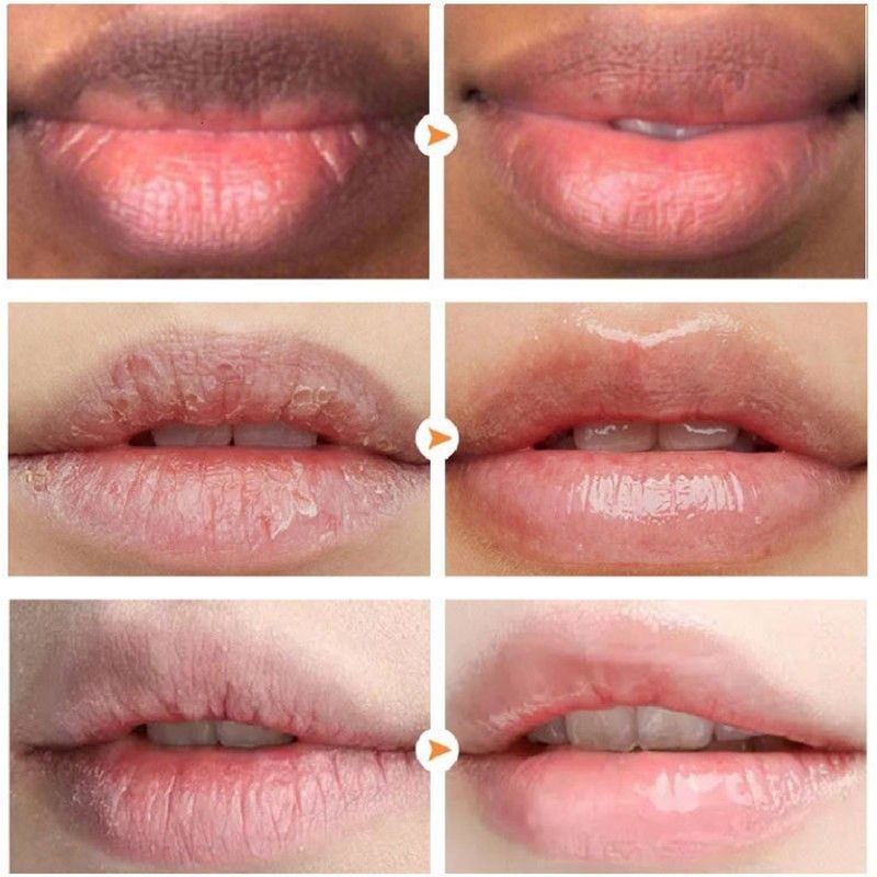 Feuchtigkeitsspendende Lippen mit Doppeleffekt, feuchtigkeitsspendend, gegen Rissbildung, Entfernung abgestorbener Hautzellen, sanfte Pflege und Reduzierung von Lippenfältchen_voghion.com