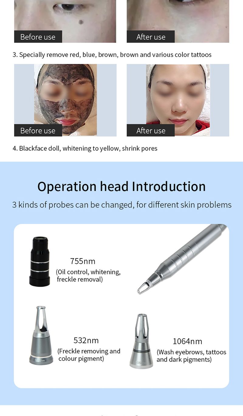 Picosecond Pen mitesszer eltávolító lézeres tetoválás eltávolító lézerrel, sötét foltokkal és demelaninnal_voghion.com
