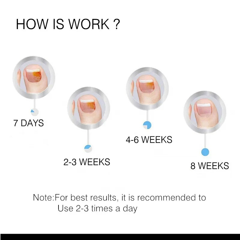 Essence de soin et de réparation des ongles à base de plantes, crème pour les ongles végétales_voghion.com