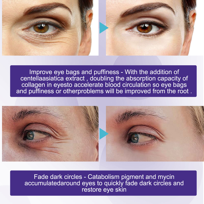 Eye Beautiful Revitalizing Cream Idrata e idrata gli occhi, solleva e rassoda la pelle, riduce le linee sottili s,_voghion.com