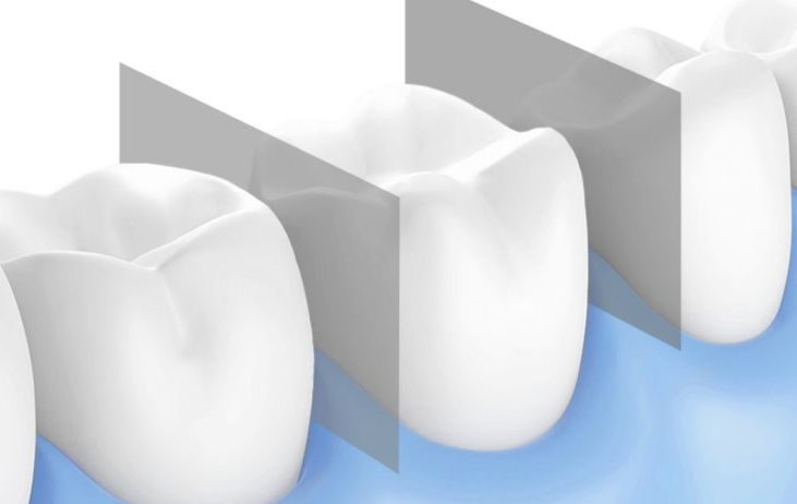Bilux Electric Irrigator Portable Teeth Cleaner With Storage Nozzle Oral Water Flosser Home Use_voghion.com