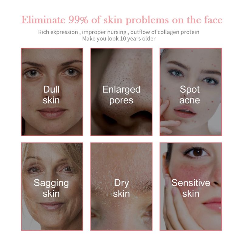 El cuidado facial 5 en 1 de Jaysuing limpia profundamente, reduce la pigmentación, las líneas finas, hidrata y protege la piel._voghion.com