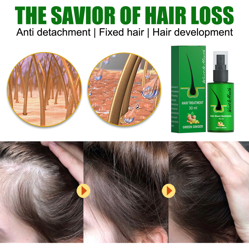 West&Month care solution prevents ginger from falling off, solidifies follicles, and nourishes black hair_voghion.com