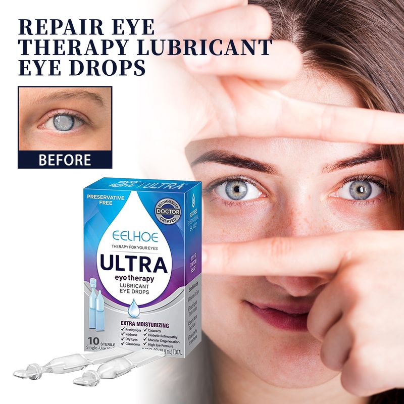 Gotas lubricantes para los ojos EELHOE: alivia el enrojecimiento, la fatiga ocular, la sequedad, la visión borrosa y humecta los ojos._voghion.com
