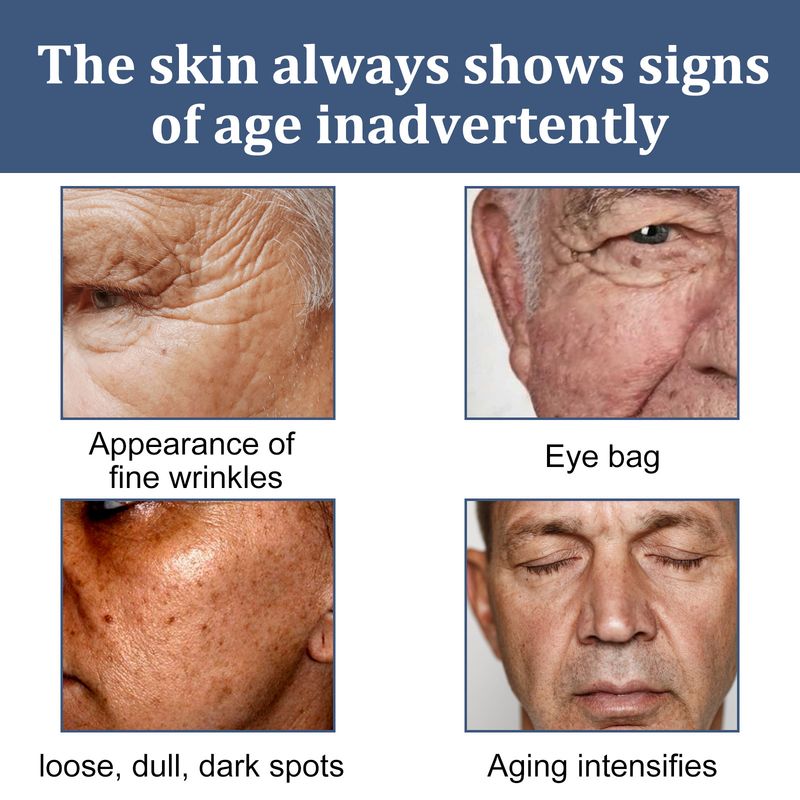 East Moon meeste niisutav näokreem. Niisutab ja vähendab peeneid jooni, silmakotte ja tumedaid ringe._voghion.com