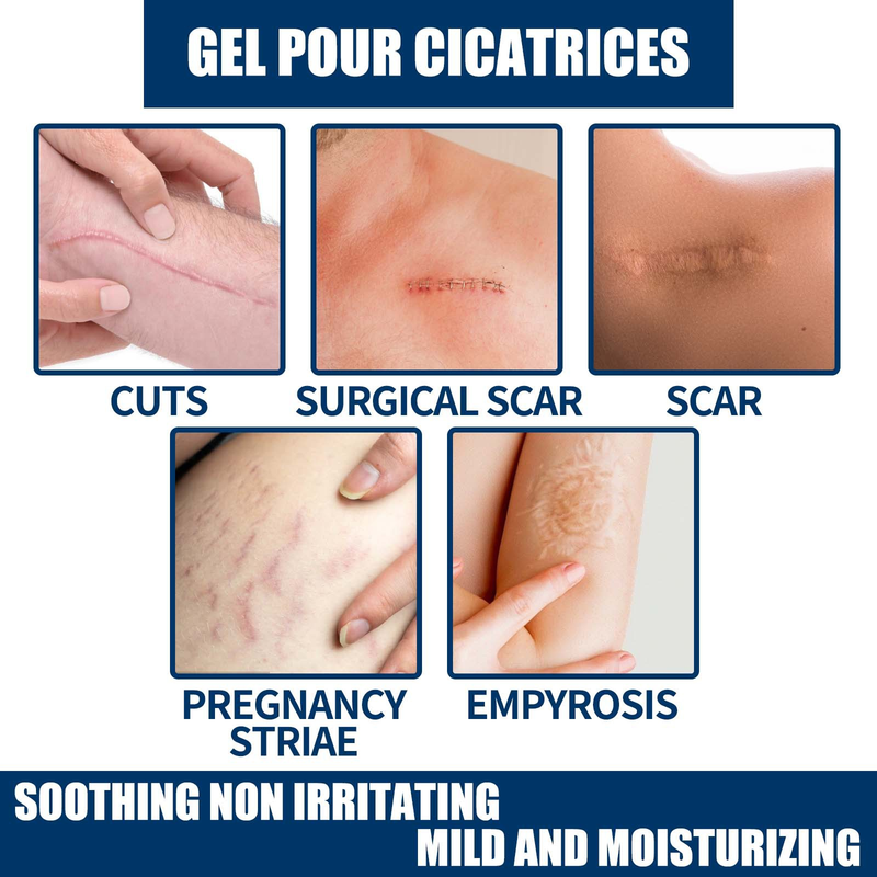 Güzel yara izi onarım jeli onarım tipi yumuşatıcı ve pürüzsüzleştirici yara izi nemlendirici topikal soğuk krem cilt hasarı_voghion.com