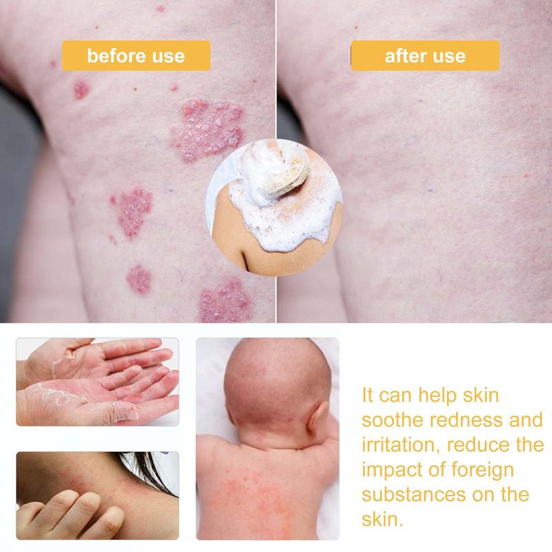 Shower Beautiful Honey Deeply Cleans, Moisturizes, and Softens the Skin, Relieving Red, Dry, and Itchy Skin Care Showe_voghion.com