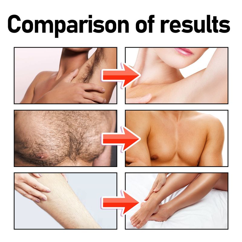 Hair Body Removal Cream Gently removes hair from armpits lips throughout body, without irritating the smooth new_voghion.com