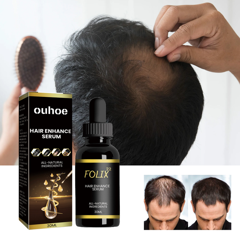 OUHOE Dense idrata le radici, ripara i capelli, ripara l'olio essenziale per la cura dei capelli danneggiati, secchi e furiosi_voghion.com
