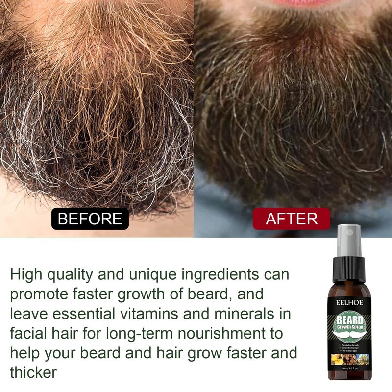 EELHOE Nourishing and Moisturizing spray Care Promotes Beard Growth Concentrate_voghion.com