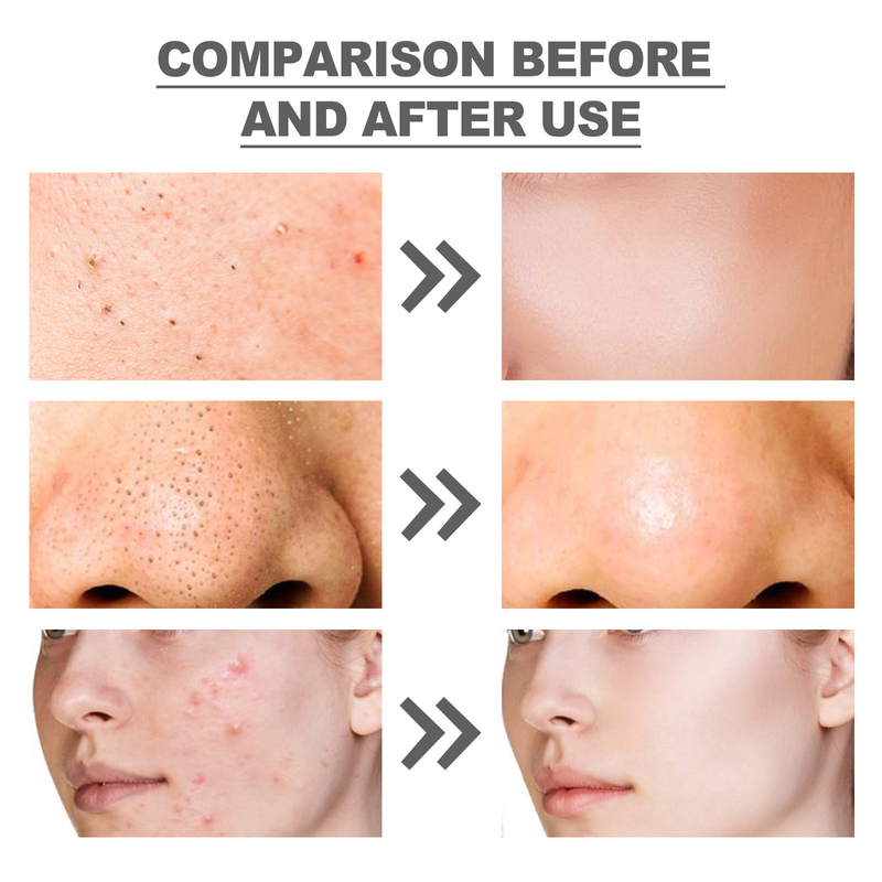 Téi OUHOE Gréng Vitamin Reinigungsmaske Gesiichtsakne Entfernt Déif Feuchtigkeitsspender Verschmierung Feinporenhaut_voghion.com